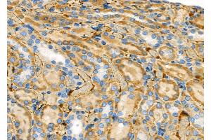 ABIN6257402 and ABIN6273969 at 1/100 staining Rat kidney tissue by IHC-P. (OR1J1 抗体  (Internal Region))