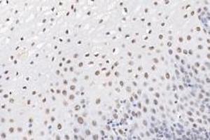 Immunohistochemistry (Paraffin-embedded Sections) (IHC (p)) image for anti-Ring Finger Protein 1 (RING1) antibody (ABIN7075467)