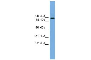 WB Suggested Anti-ARHGEF19 Antibody Titration: 0. (ARHGEF19 抗体  (Middle Region))