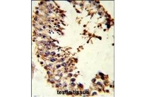 Formalin-fixed and paraffin-embedded human testis tissue reacted with ACR Antibody (Center), which was peroxidase-conjugated to the secondary antibody, followed by DAB staining. (Acrosin 抗体  (AA 99-127))