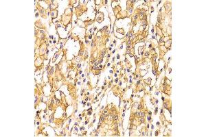 Immunohistochemistry (IHC) image for anti-Basigin (Ok Blood Group) (BSG) (AA 30-200) antibody (ABIN1512647)