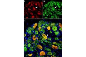 Multiplex staining of ASIC1 and ASIC3 in rat DRG - Immunohistochemical staining of perfusion-fixed frozen rat dorsal root ganglia (DRG) sections using Guinea pig Anti-ASIC1 Antibody (ABIN7042914, ABIN7045410 and ABIN7045411), (1:400) and rabbit Anti-ASIC3 Antibody (ABIN7042917, ABIN7045243 and ABIN7045244), (1:400). (ASIC3 抗体  (Intracellular))