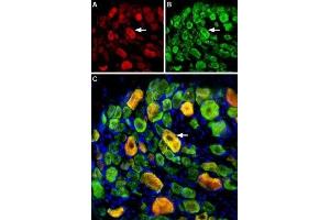 Multiplex staining of ASIC1 and ASIC3 in rat DRG - Immunohistochemical staining of perfusion-fixed frozen rat dorsal root ganglia (DRG) sections using Guinea pig Anti-ASIC1 Antibody (ABIN7042914, ABIN7045410 and ABIN7045411), (1:400) and rabbit Anti-ASIC3 Antibody (ABIN7042917, ABIN7045243 and ABIN7045244), (1:400). (ASIC3 抗体  (Intracellular, N-Term))