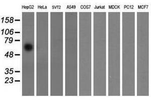 Image no. 2 for anti-Formiminotransferase Cyclodeaminase (FTCD) antibody (ABIN1496382) (FTCD 抗体)
