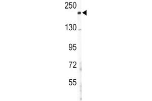 Western Blotting (WB) image for anti-Collagen, Type V, alpha 2 (COL5A2) antibody (ABIN3003163) (COL5A2 抗体)