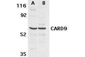 Western blot analysis of CARD9 expression in human MDA- MB-361 (A) and PC-3 (B) cell lysate withCARD9 antibody at 2. (CARD9 抗体)