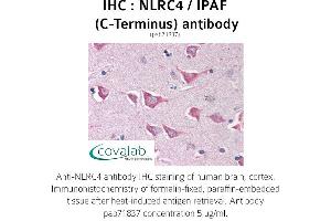 Image no. 1 for anti-NLR Family, CARD Domain Containing 4 (NLRC4) antibody (ABIN1737383) (NLRC4 抗体)