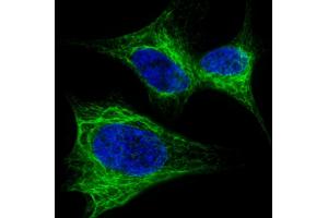 Fluorescent confocal image of SH-SY5Y cells stained with Nestin  antibody. (Nestin 抗体  (AA 1389-1416))