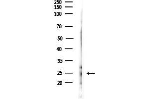 anti-BCL2-Like 11 (Apoptosis Facilitator) (BCL2L11) (pSer77) antibody