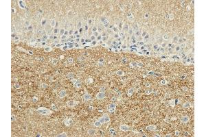 Immunohistochemical staining of rabbit brain using anti-SNAP25 antibody ABIN7072250 Formalin fixed rabbit brain slices were were stained with a ABIN7072250 at 3 μg/mL. (Recombinant SNAP25 抗体)
