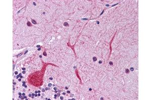 EIF2AK1 antibody was used for immunohistochemistry at a concentration of 4-8 ug/ml. (EIF2AK1 抗体  (N-Term))