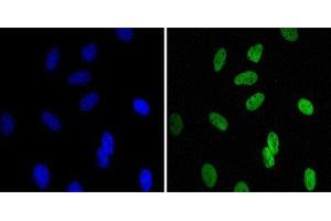 Immunocytochemistry (ICC) image for anti-Chromobox Homolog 1 (CBX1) antibody (ABIN1845962) (CBX1 抗体)
