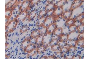 DAB staining on IHC-P; Samples: Mouse Kidney Tissue (ATP1B1 抗体  (AA 53-304))