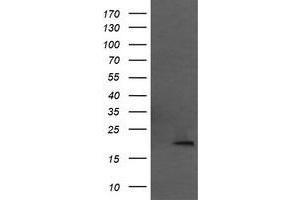 Image no. 1 for anti-Mitochondrial Ribosomal Protein L11 (MRPL11) antibody (ABIN1499556) (MRPL11 抗体)