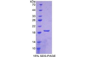 SDS-PAGE analysis of Rabbit SOD1 Protein.