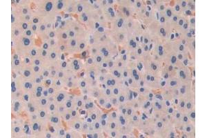 Immunohistochemistry (IHC) image for anti-Permeability Glycoprotein (AA 394-672) antibody (ABIN7433945)