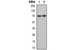 Western blot analysis of HGF activator expression in K562 (A), Jurkat (B) whole cell lysates. (HGFA 抗体  (C-Term))