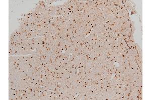 Immunohistochemistry (IHC) image for anti-Cofilin 1 (CFL1) (pSer3) antibody (ABIN6255180)
