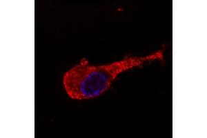 Immunocytochemistry (ICC) image for anti-Neurofilament Triplet M Protein (NEFM) antibody (ABIN94435)