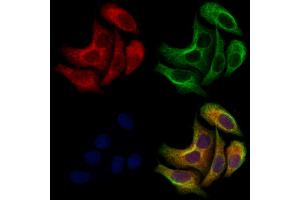 ABIN7094678 and ABIN7098729 staining Hela cells by IF/ICC.