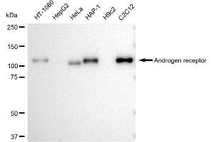 Western blotting analysis using Androgen receptor antibody (ABIN7797599). (Recombinant Androgen Receptor 抗体)