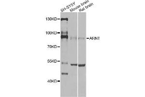 Western blot analysis of extracts of various cell lines, using ARNT Antibody (ABIN5970360) at 1/1000 dilution. (ARNT 抗体)