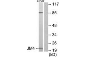 Western blot analysis of extracts from LOVO cells, using JM4 Antibody. (PRAF2 抗体  (AA 129-178))