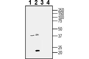 Western blot analysis of human PC3 prostate adenocarcinoma cell line lysates (lanes 1 and 3) and human MDA- breast adenocarcinoma cell line lysate (lanes 2 and 4):1-2. (CD81 抗体  (Extracellular))