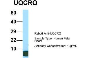 Host: Rabbit  Target Name: UQCRQ  Sample Tissue: Human Fetal Heart  Antibody Dilution: 1. (UQCRQ 抗体  (Middle Region))