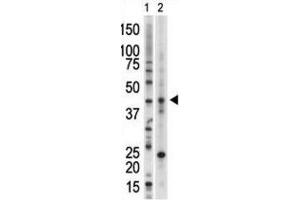 Western Blotting (WB) image for anti-Vaccinia Related Kinase 1 (VRK1) antibody (ABIN3003194) (VRK1 抗体)