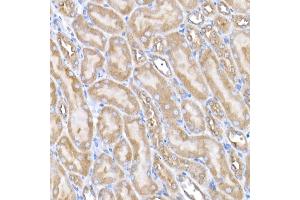 Immunohistochemistry of paraffin-embedded mouse kidney using USO1 Rabbit mAb (ABIN7271234) at dilution of 1:25 (40x lens). (USO1 抗体)
