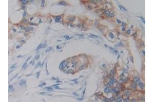 Immunohistochemistry (IHC) image for anti-Doublecortin-Like Kinase 1 (DCLK1) (AA 390-647) antibody (ABIN7436015)