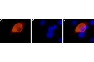 Immunocytochemistry (ICC) image for anti-Transient Receptor Potential Cation Channel, Subfamily V, Member 1 (TRPV1) (AA 824-838), (Intracellular) antibody (ABIN7043841)