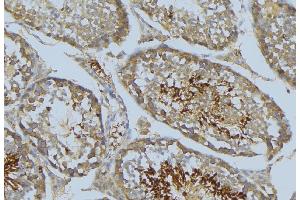 ABIN6269276 at 1/100 staining Mouse testis tissue by IHC-P. (VASP 抗体  (Internal Region))