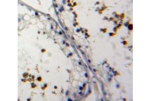 Used in DAB staining on fromalin fixed paraffin-embedded testis tissue (NUP62 抗体  (AA 186-432))