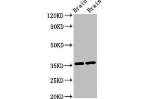 Western Blot Positive WB detected in: Mouse brain tissue, Rat brain tissue All lanes: NIT1 antibody at 3 μg/mL Secondary Goat polyclonal to rabbit IgG at 1/50000 dilution Predicted band size: 36, 32, 41, 35, 27 kDa Observed band size: 36 kDa (Nitrilase 1 抗体  (AA 1-243))