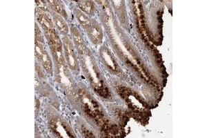 Immunohistochemical staining of human stomach with SLC41A2 polyclonal antibody  shows strong cytoplasmic positivity in glandular cells at 1:50-1:200 dilution.