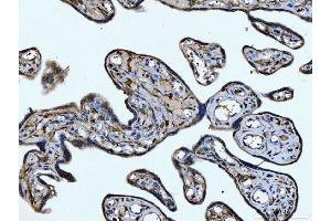 IHC analysis of CD14 using anti-CD14 antibody (ABIN7600531). (CD14 抗体  (AA 20-259))