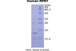 SDS-PAGE analysis of Human Ribophorin I Protein. (RPN1 蛋白)