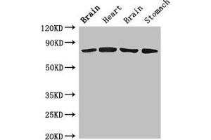 Western Blot Positive WB detected in: Rat brain tissue, Rat heart tissue, Mouse brain tissue, Mouse stomach tissue All lanes: SLCO1B1 antibody at 4 μg/mL Secondary Goat polyclonal to rabbit IgG at 1/50000 dilution Predicted band size: 77 kDa Observed band size: 77 kDa