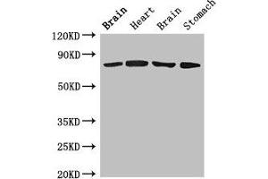 Western Blot Positive WB detected in: Rat brain tissue, Rat heart tissue, Mouse brain tissue, Mouse stomach tissue All lanes: SLCO1B1 antibody at 4 μg/mL Secondary Goat polyclonal to rabbit IgG at 1/50000 dilution Predicted band size: 77 kDa Observed band size: 77 kDa (SLCO1B1 抗体  (AA 426-537))