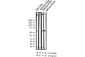 CHEK2 antibody  (pThr68)