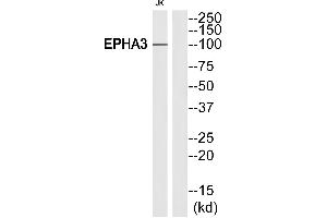 Western blot analysis of extracts from Jurkat cells, using EPHA3 (Ab-602)antibody. (EPH Receptor A3 抗体  (Internal Region))
