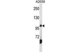AP2B1 Antibody (Center) western blot analysis in A2058 cell line lysates (35µg/lane). (AP2B1 抗体  (Middle Region))