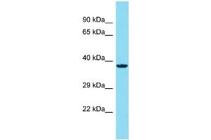 Host: Rabbit Target Name: C14orf79 Sample Type: HepG2 Whole Cell lysates Antibody Dilution: 1. (C14ORF79 抗体  (N-Term))