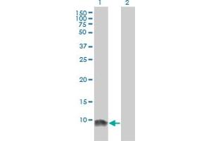 Western Blot analysis of LSM6 expression in transfected 293T cell line by LSM6 monoclonal antibody (M01), clone 4B5-1B10. (LSM6 抗体  (AA 1-80))