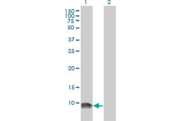 LSM6 Antikörper  (AA 1-80)