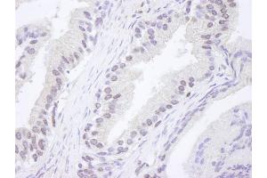 Immunohistochemistry (IHC) image for anti-Ataxia Telangiectasia Mutated (ATM) (AA 2550-2600) antibody (ABIN7448423)