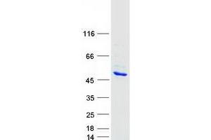 Western Blotting (WB) image for Sister Chromatid Cohesion Protein DCC1 (DSCC1) protein (Myc-DYKDDDDK Tag) (ABIN2719766)