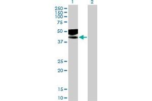 Western Blotting (WB) image for anti-Interleukin 1 Receptor, Type II (IL1R2) (AA 1-398) antibody (ABIN521667)